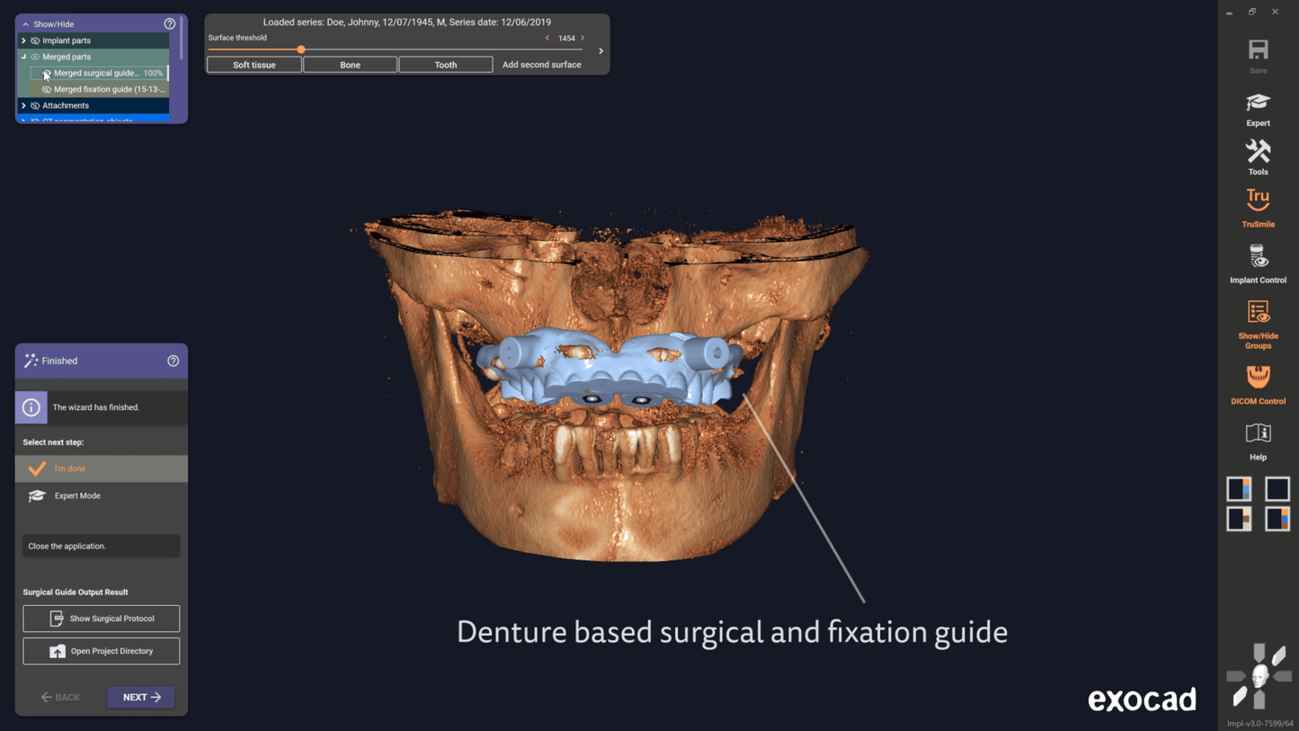 Exocad 9036 AI + partialCad 3.2 gratuit