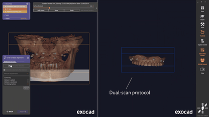 Exocad 9036 AI + partialCad 3.2 gratuit
