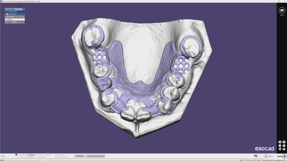 Exocad 9036 AI + partialCad 3.2 gratuit